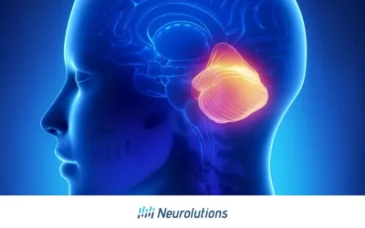 Guide to Cerebellum Stroke — Cauѕes, After Effects, and Recoveгy